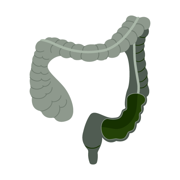 GASTRO_INTESTINAL_DISORDERS_ULCERATIVE_COLITIS