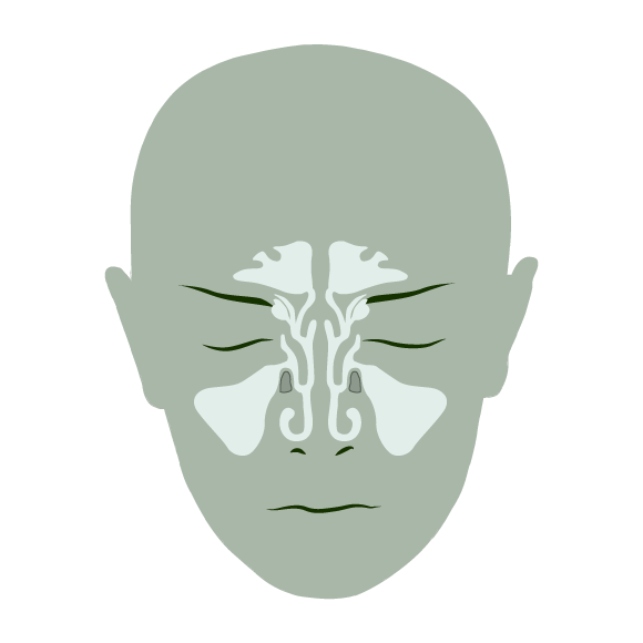 RESPIRATORY_AILMENTS_PULMONARY_SINUSITIS