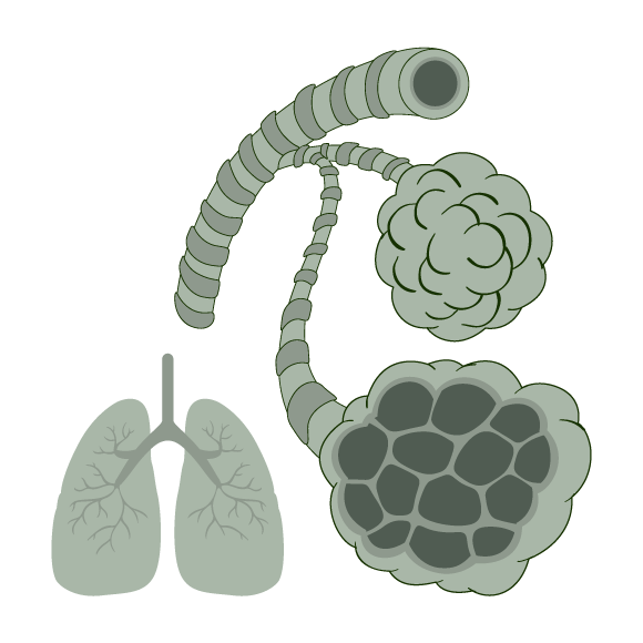 RESPIRATORY_AILMENTS_PULMONARY_FIBROSIS