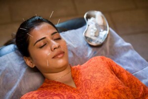 Accupunture Accupunture