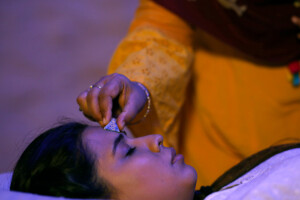 Naturopathy Treatment